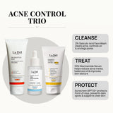 Acne Control Routine