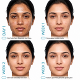 10% Niacinamide Serum with Rice Water & Zinc Pca